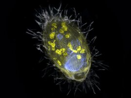Der Endosymbiont und sein Wirt, ein Wimpertierchen. Der Endosymbiont und sein Wirt, ein Wimpertierchen.