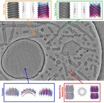 Kryo-EM zeigt verschiedene Vipp1-Strukturen